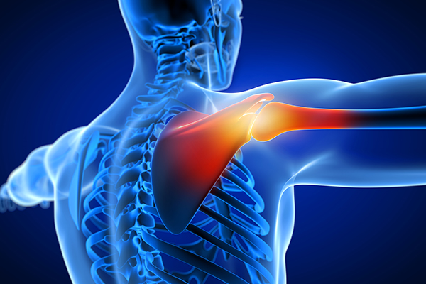 shoulder injury compensation claims